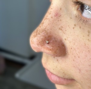 Fresh Nose Body Piercing By Khem at Iron Palm Tattoos. Khem is the resident master piercer at Iron Palm Tattoos. Nose piercings at Iron Palm include jewelry with the service. Call 404-973-7828 or stop by for a free consultation. Walk Ins are welcome.